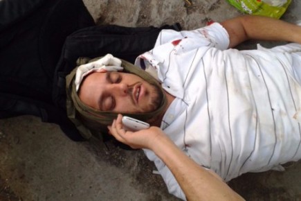 A Jewish hiker after being hit in the head by Arab stone throwers in Jerusalem.