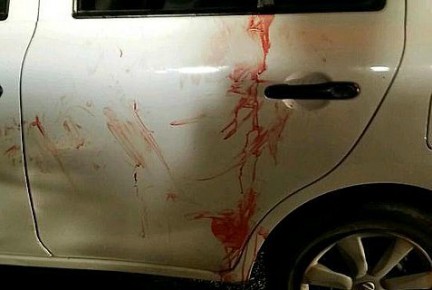 Malachi Moshe Rosenfeld's car after the attack