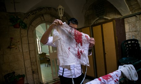 Bloody tallit worn by stab victim